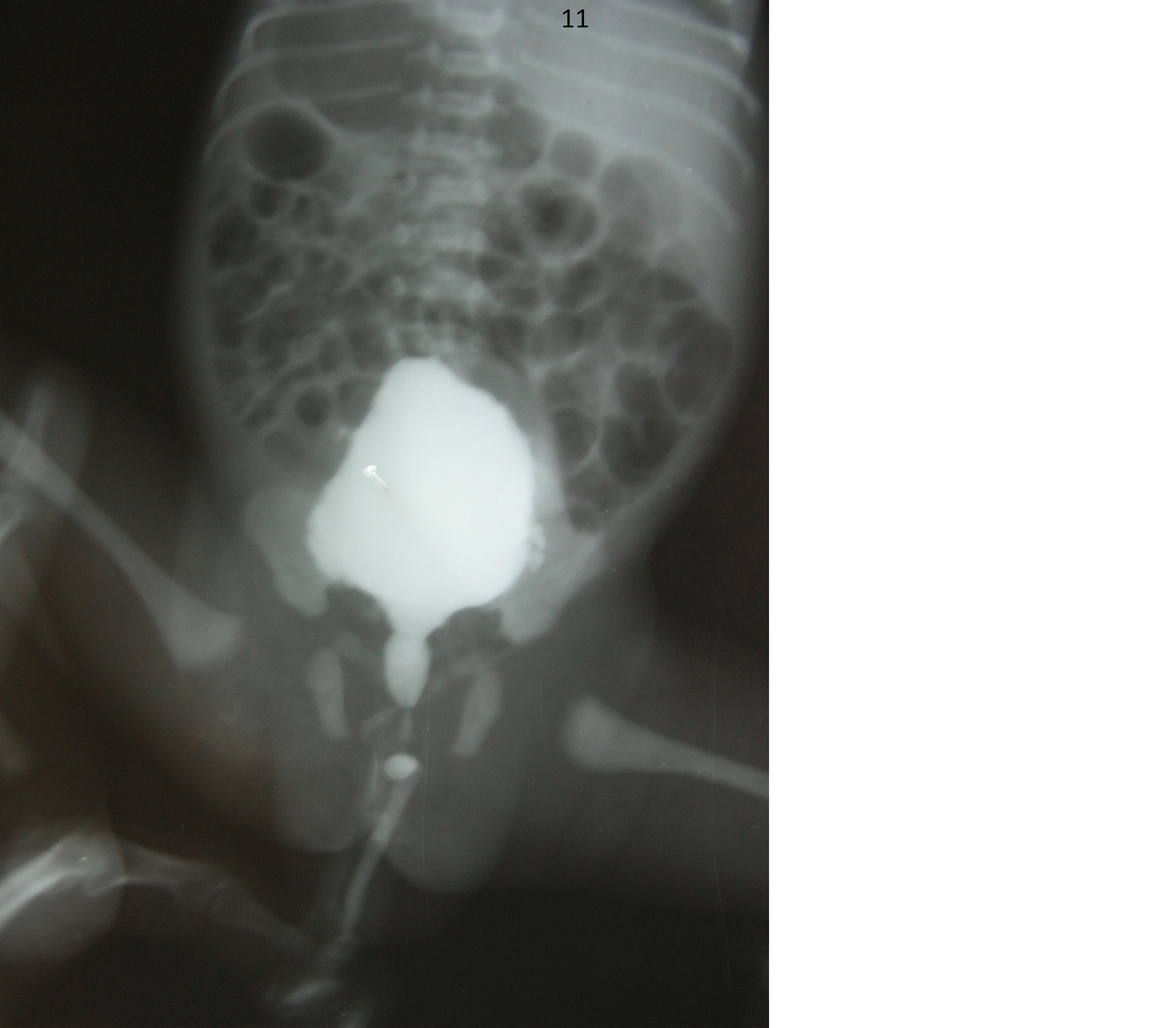 Pediatric Urology Image 7